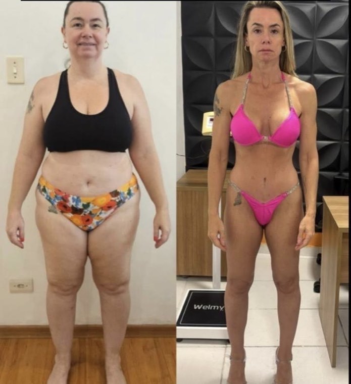 Antes e depois de aluna acompanhada pelo Fábio