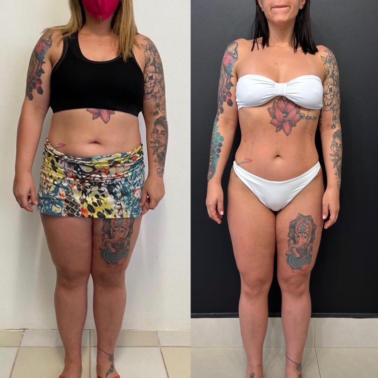 Antes e depois de aluna acompanhada pelo Fábio